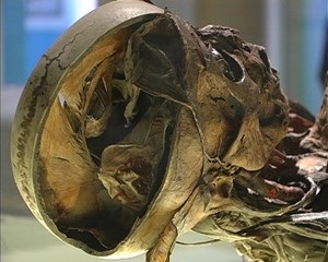 Geheimnisse der Anatomie in Gotha