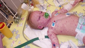 Erfurter Familie k�mpft seit 10 Jahren